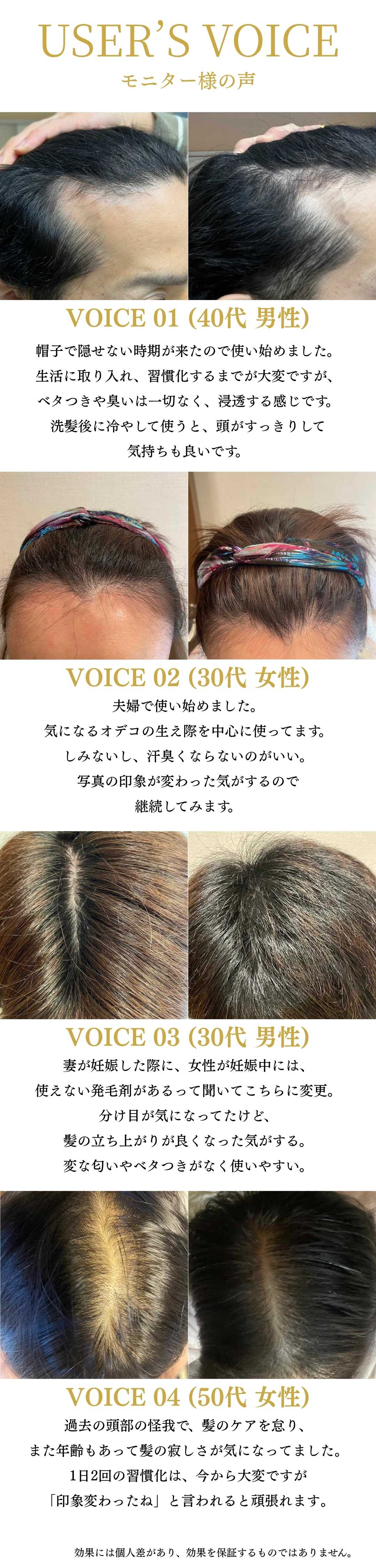 USER VOICE